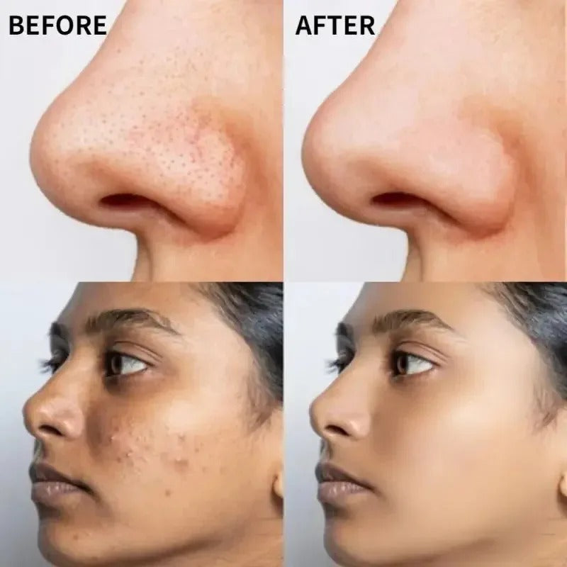 The Ordinary Vitamin C Suspension 30% in Silicone โ Brightening Serum for Radiant, Even-Toned Skin - Imported Quality